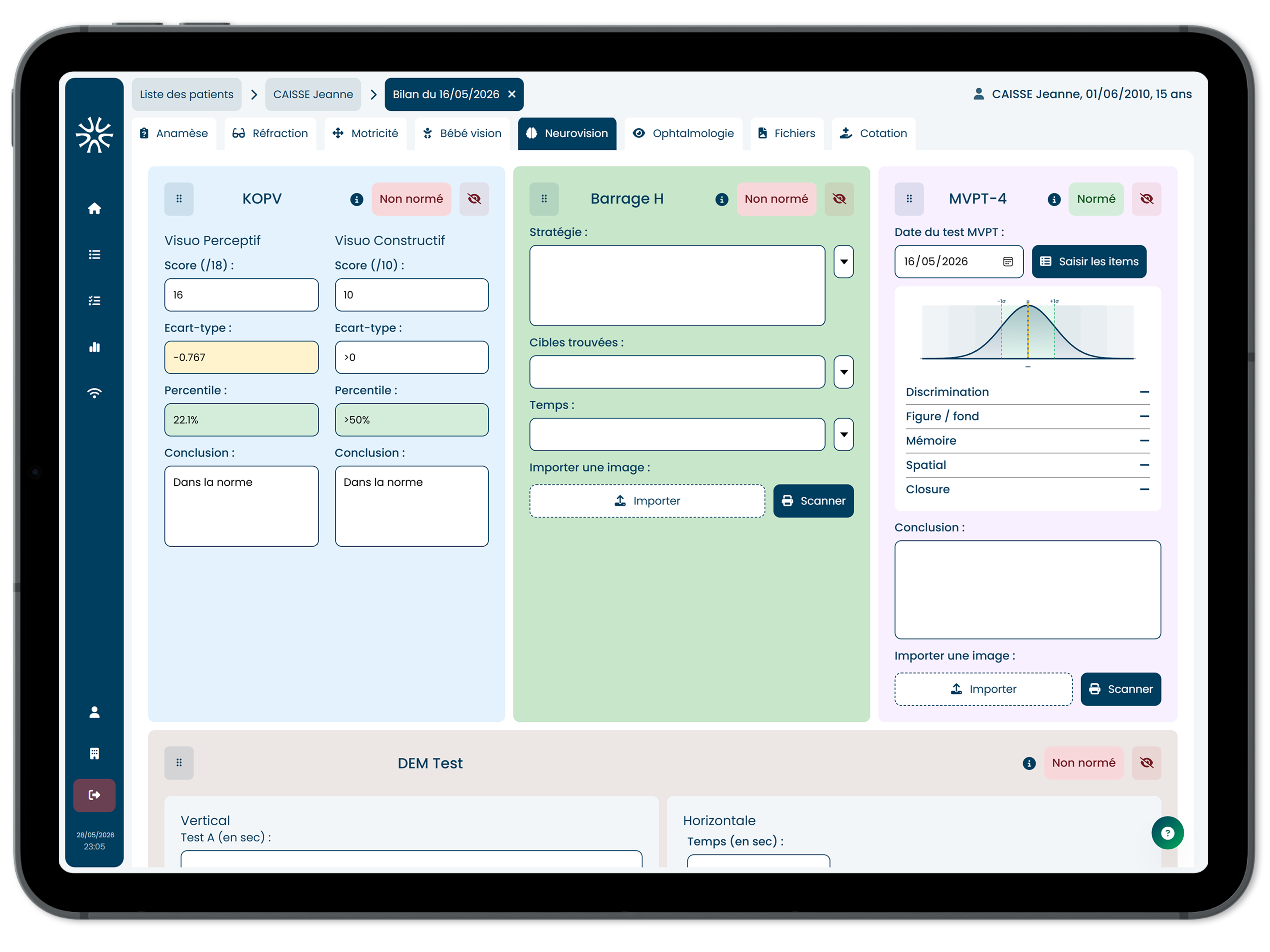 Calcul automatique du KOPV sur iPad