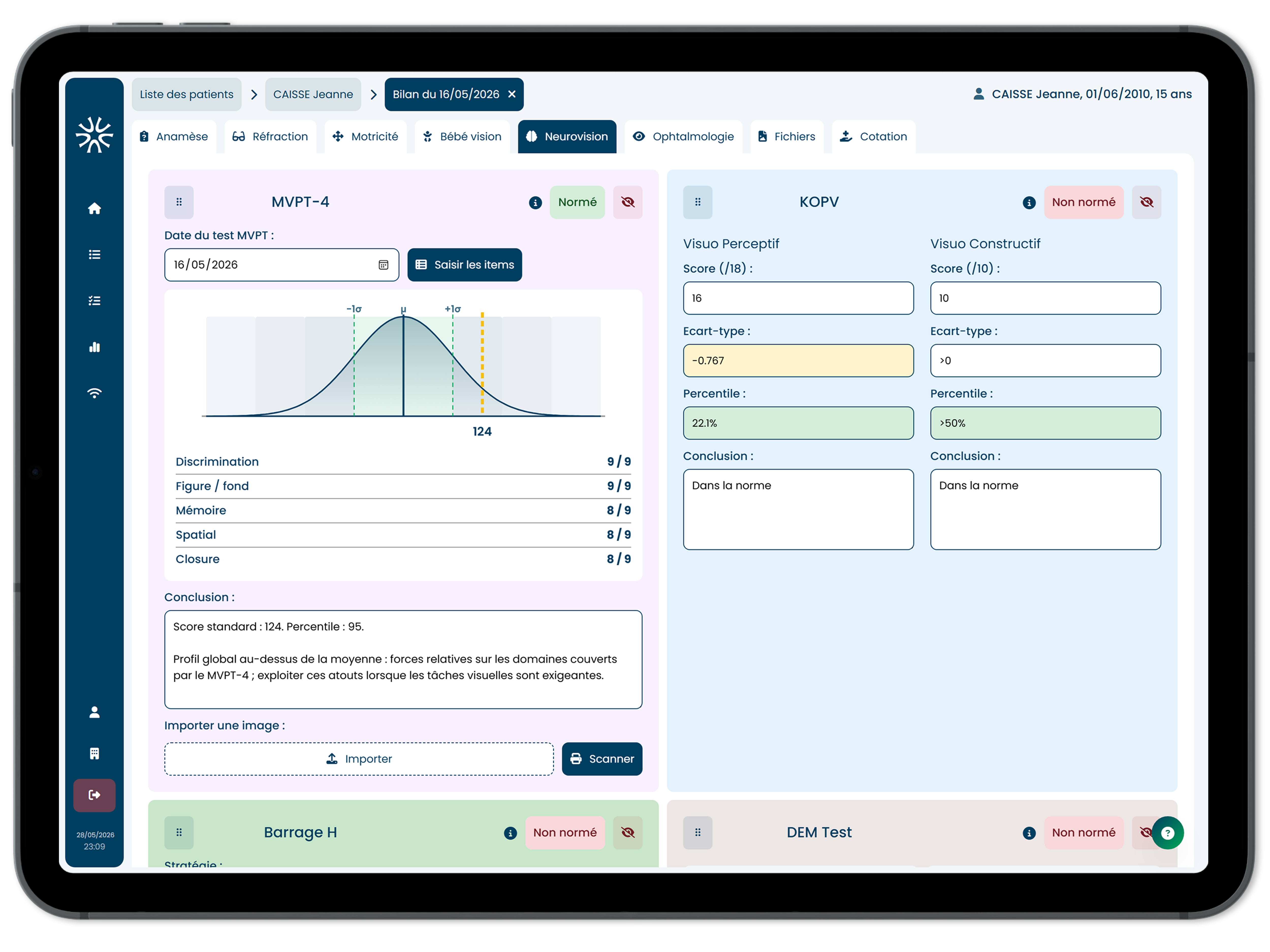 Interprétation du MVPT-4 sur iPad